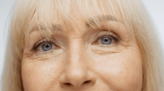 23.aging-marks-senior-woman-eyes-with-crows-feet-looking-at-camera-close-up-portrait-o-SBV-346673211-HD